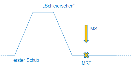 MS Diagnose mod McDonalds Kriterien1
